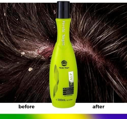 Perola Negra Shampoo Scalp Anti-Dandruff Treatment - Refreshing Effect - for All Hair Types 10,14 fl.oz Green