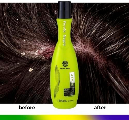 Perola Negra Shampoo Scalp Anti-Dandruff Treatment - Refreshing Effect - for All Hair Types 10,14 fl.oz Green