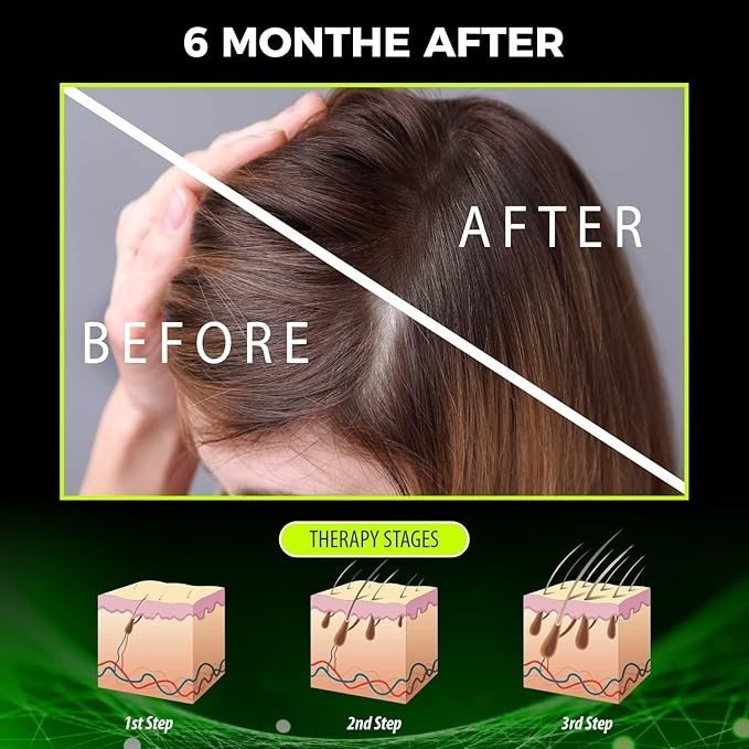 Perola Negra Vegan Anti-Hair Loss Therapy kit Shampoo and Conditioner, for Hair Growth and Thinning Hair - 10.44 fl.oz, Perola Negra Anti-Hair Loss Vegan Tonic, Reduce hair loss, Hair nourishing 4.05 fl.oz